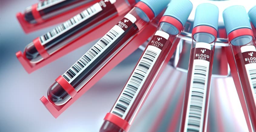 İşe Giriş Tetkikleri - 1